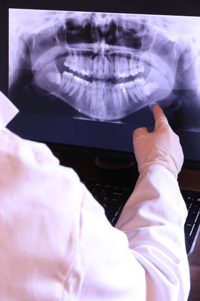 Best Emergency Dentist for Lost Fillings or Crowns in North Bend, OH